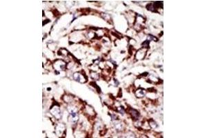 Image no. 1 for anti-Palmitoyl-Protein Thioesterase 1 (PPT1) (C-Term) antibody (ABIN357784) (PPT1 anticorps  (C-Term))