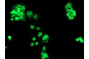 Anti-CHN1 mouse monoclonal antibody (ABIN2455946) immunofluorescent staining of COS7 cells transiently transfected by pCMV6-ENTRY CHN1 (RC222163). (CHN1 anticorps)