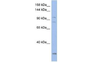 WB Suggested Anti-KCNQ5 Antibody Titration:  0. (KCNQ5 anticorps  (Middle Region))