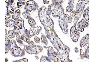 IHC analysis of VEGF Receptor 3 using anti-VEGF Receptor 3 antibody .