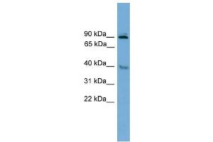 WB Suggested Anti-L3mbtl Antibody Titration: 0. (L3MBTL1 anticorps  (Middle Region))