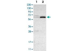 Western Blot analysis of Lane 1: RT-4 and Lane 2: U-251 MG sp cell lysates with CRAT polyclonal antibody . (CRAT anticorps)