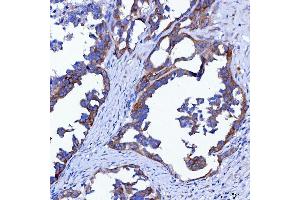 IHC analysis of SWAP70 using anti-SWAP70 antibody (ABIN7600201).