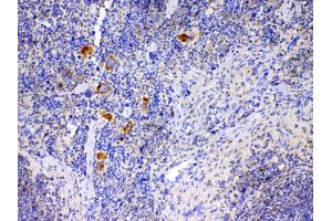IHC analysis of IL12A using anti-IL12A antibody .