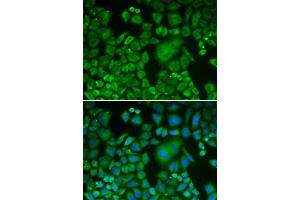 Immunofluorescence analysis of HeLa cells using ACTR3 antibody. (ACTR3 anticorps  (AA 1-418))