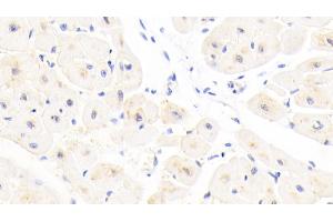 Detection of GSTA4 in Human Cardiac Muscle Tissue using Polyclonal Antibody to Glutathione S Transferase A4 (GSTA4)