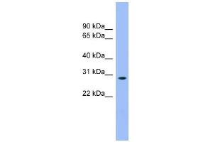 WB Suggested Anti-ENOPH1 Antibody Titration: 0. (MASA anticorps  (N-Term))
