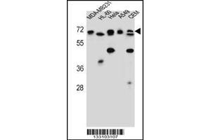 Western blot analysis in MDA-MB231,HL-60,Hela,A549,CEM cell line lysates (35ug/lane). (ASMTL anticorps  (AA 231-259))