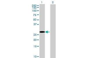 Lane 1: CFHR2 transfected lysate ( 30. (CFHR2 293T Cell Transient Overexpression Lysate(Denatured))