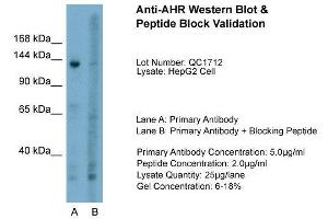 Host:  Rabbit  Target Name:  AHR  Sample Type:  HepG2  Lane A:  Primary Antibody  Lane B:  Primary Antibody + Blocking Peptide  Primary Antibody Concentration:  5. (Aryl Hydrocarbon Receptor anticorps  (N-Term))