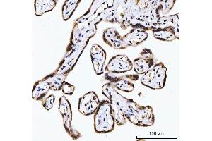 IHC analysis of RING2/RING1B/RNF2 using anti-RING2/RING1B/RNF2 antibody (ABIN7599286). (RNF2 anticorps  (AA 1-336))