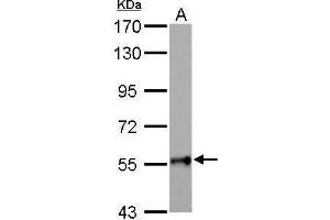 WB Image GALNT2 antibody detects GALNT2 protein by Western blot analysis.