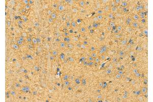 ABIN6262957 and ABIN6273262 at 1/100 staining Mouse brain tissue by IHC-P.