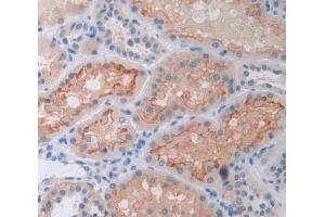 Used in DAB staining on fromalin fixed paraffin- embedded Kidney tissue (CD38 anticorps  (AA 81-298))