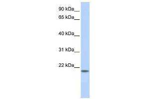 FLJ33706 antibody used at 5 ug/ml to detect target protein. (FLJ33706 (C-Term) anticorps)