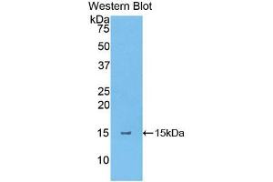 Western blot analysis of the recombinant protein. (Thymic Stromal Lymphopoietin anticorps  (AA 75-196))