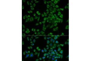 Immunofluorescence analysis of U2OS cells using P2RY2 Polyclonal Antibody (P2RY2 anticorps)
