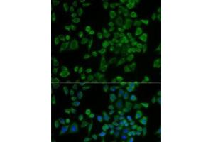 Immunofluorescence analysis of U2OS cells using P2RY2 Polyclonal Antibody
