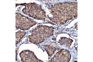 IHC analysis of SDF2L1 using anti-SDF2L1 antibody (ABIN7601111). (SDF2L1 anticorps  (AA 29-221))