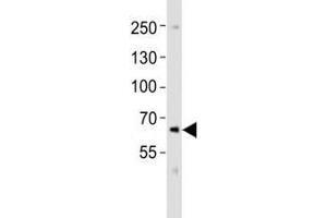 Western blot analysis of lysate from SK-N-MC cell line using PCSK9 antibody at 1:1000.