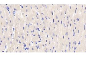 Detection of JNK1 in Mouse Cardiac Muscle Tissue using Polyclonal Antibody to c-Jun N-terminal Kinase 1 (JNK1)