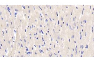 Detection of JNK1 in Mouse Cardiac Muscle Tissue using Polyclonal Antibody to c-Jun N-terminal Kinase 1 (JNK1) (C-Jun N-Terminal Kinases (AA 138-382) anticorps)