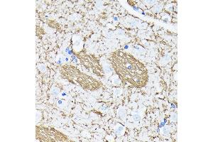 Immunohistochemistry of paraffin-embedded human brain using APP Rabbit mAb (ABIN7265575) at dilution of 1:100 (40x lens). (APP anticorps)