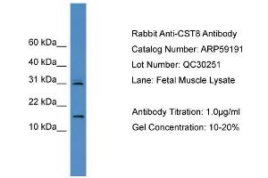WB Suggested Anti-CST8  Antibody Titration: 0.