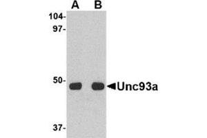 Western blot analysis of Unc93a in HeLa cell lysate with this product at (A) 0.