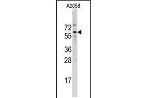 Western blot analysis of Cdc25B Antibody (A166) in A2058 cell line lysates (35ug/lane) (CDC25B anticorps  (N-Term))