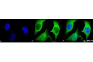 Immunocytochemistry/Immunofluorescence analysis using Mouse Anti-Ubiquitin Monoclonal Antibody, Clone 5B9-B3 .