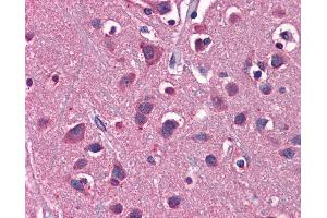 Immunohistochemistry (IHC) image for anti-Solute Carrier Family 1 (Glial High Affinity Glutamate Transporter), Member 2 (SLC1A2) (N-Term) antibody (ABIN2778148)