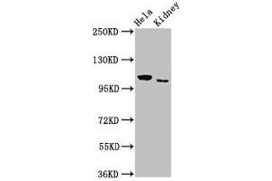 Western Blot Positive WB detected in: Hela whole cell lysate, Rat kidney tissue All lanes: NEK9 antibody at 3 μg/mL Secondary Goat polyclonal to rabbit IgG at 1/50000 dilution Predicted band size: 108 kDa Observed band size: 108 kDa
