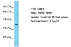 Image no. 1 for anti-YTH Domain Family, Member 1 (YTHDF1) (AA 127-176) antibody (ABIN6750377) (YTHDF1 anticorps  (AA 127-176))
