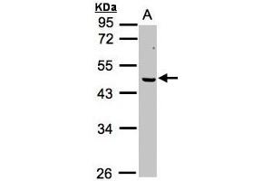Image no. 1 for anti-Excision Repair Cross-Complementing Rodent Repair Deficiency, Complementation Group 8 (ERCC8) (AA 1-164) antibody (ABIN467383) (ERCC8 anticorps  (AA 1-164))