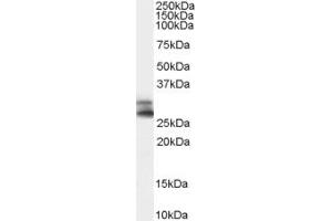 Western Blotting (WB) image for anti-ADP-Ribosylation-Like Factor 6 Interacting Protein 4 (ARL6IP4) (Middle Region) antibody (ABIN2790727) (ARL6IP4 anticorps  (Middle Region))