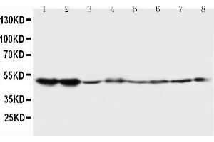 Lane 8: COLO320 Cell Lysate