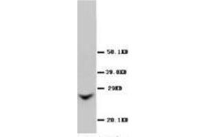 Western blot analysis of Rat liver sections using Connexin 26 antibody (GJB2 anticorps  (Middle Region))