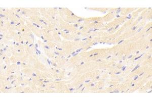Detection of ERb in Mouse Cardiac Muscle Tissue using Polyclonal Antibody to Estrogen Receptor Beta (ERb) (ESR2 anticorps  (AA 46-530))