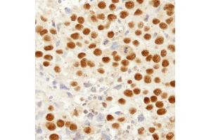 Immunohistochemistry (IHC) image for anti-Mismatch Repair Protein 2 (MSH2) (C-Term) antibody (ABIN7448673) (MSH2 anticorps  (C-Term))
