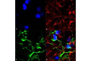 Immunocytochemistry/Immunofluorescence analysis using Mouse Anti-SUR2A Monoclonal Antibody, Clone S319A-14 (ABIN2482983).