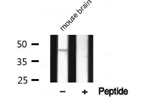 Western blot analysis on mouse brain lysate using DLX3 Antibody