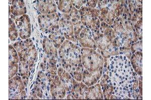 Image no. 1 for anti-Myeloid Differentiation Primary Response Gene (88) (MYD88) antibody (ABIN1499612)