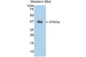 Western Blotting (WB) image for anti-Janus Kinase 2 (JAK2) (AA 508-800) antibody (ABIN3203633) (JAK2 anticorps  (AA 508-800))