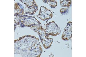 Immunohistochemistry of paraffin-embedded human placenta using FCGR1B antibody (ABIN7267161) at dilution of 1:100 (40x lens).