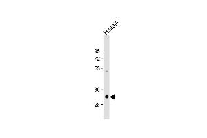 Anti-NMNAT1 Antibody (C-Term) at 1:2000 dilution + human brain lysate Lysates/proteins at 20 μg per lane.
