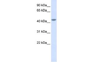 WB Suggested Anti-IL11RA Antibody Titration:  0. (IL11RA anticorps  (Middle Region))