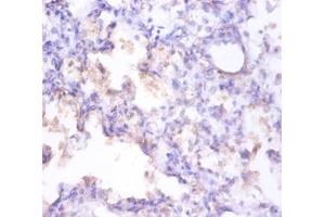 Immunohistochemistry of paraffin-embedded human prostate using CLU / Clusterin antibody at dilution of 1:100. (Clusterin anticorps  (FITC))