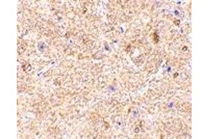 Immunohistochemistry (IHC) image for anti-Mitochondrial Antiviral Signaling Protein (MAVS) (Middle Region) antibody (ABIN1031160)