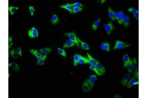 Immunofluorescence staining of HepG2 cells with ABIN7156855 at 1:333, counter-stained with DAPI. (IL22 Receptor alpha 1 anticorps  (AA 250-573))